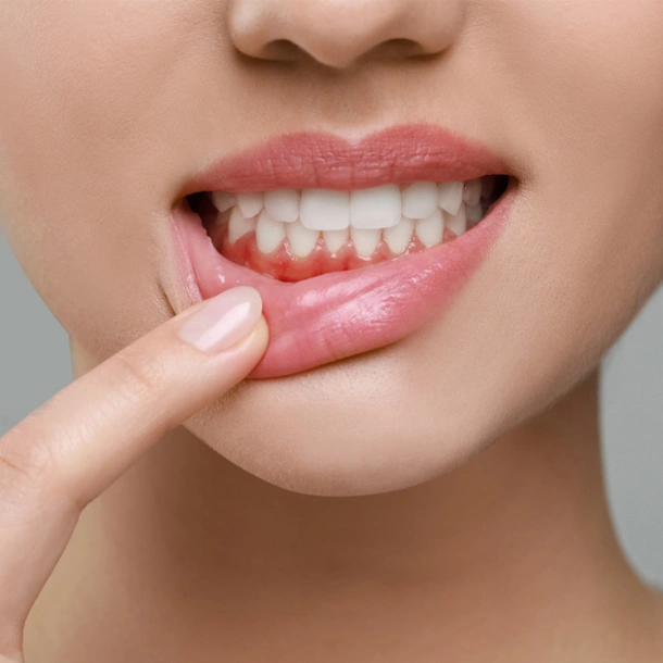 Woman pointing to lower lip showing healthy teeth and gums, close-up portrait.