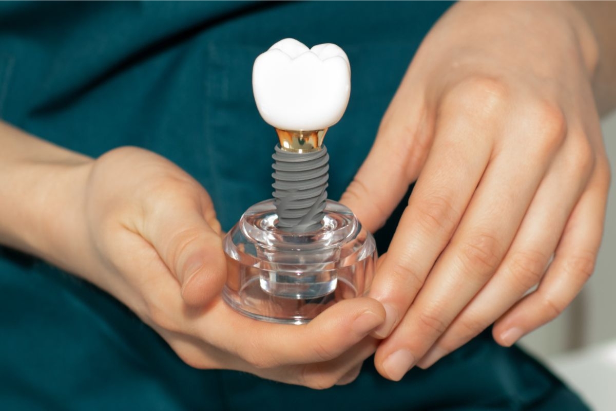 How Dental Implants Help Maintain Proper Tooth Alignment