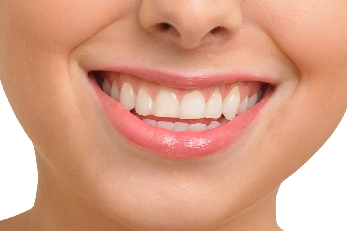 Fixing a ‘Gummy Smile’: Periodontists Share Solutions