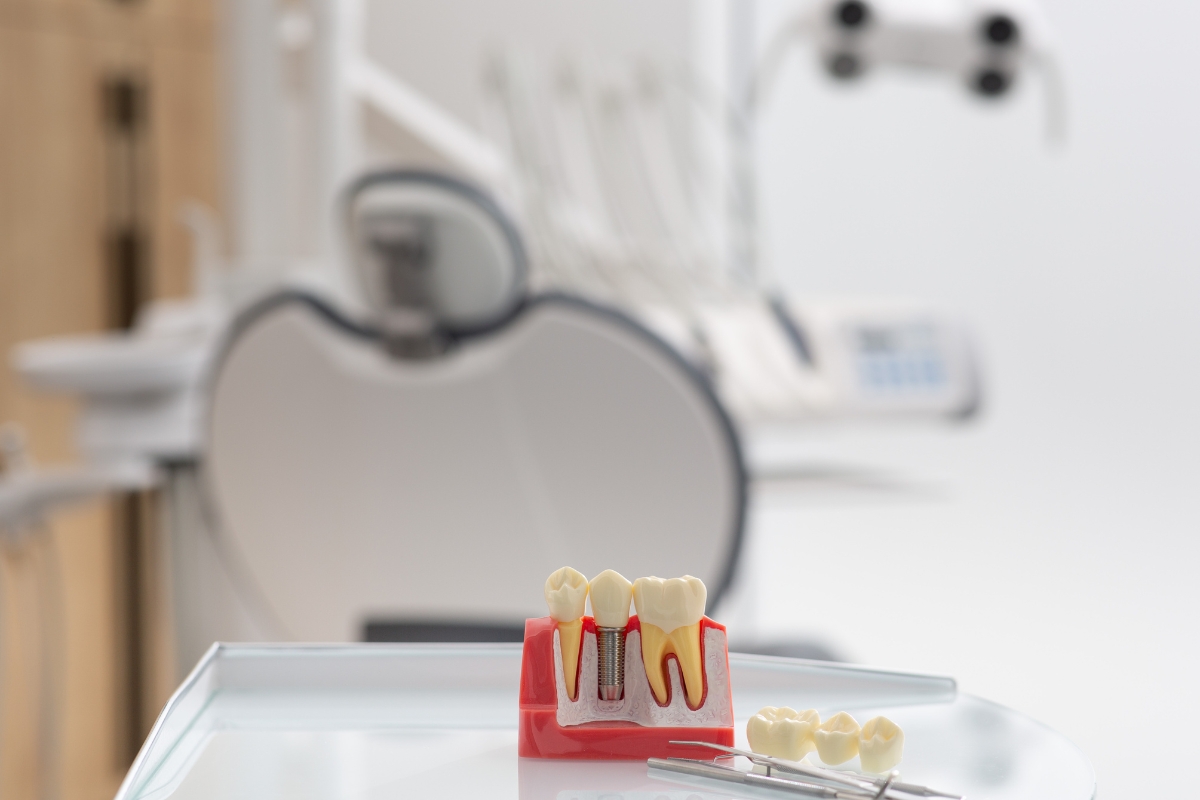 Can You Get an MRI with Dental Implants? What You Need to Know
