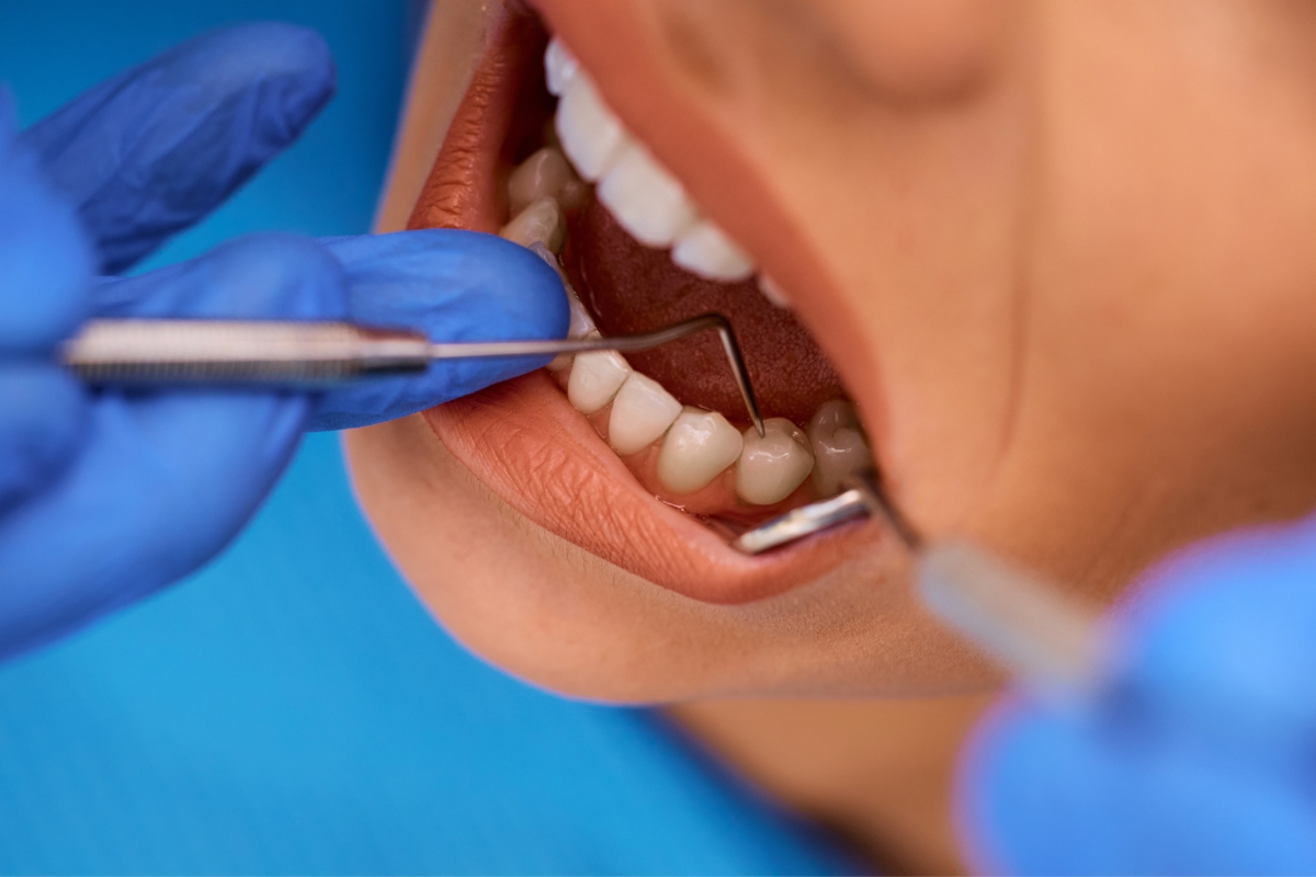 What’s Making My Gums Shrink