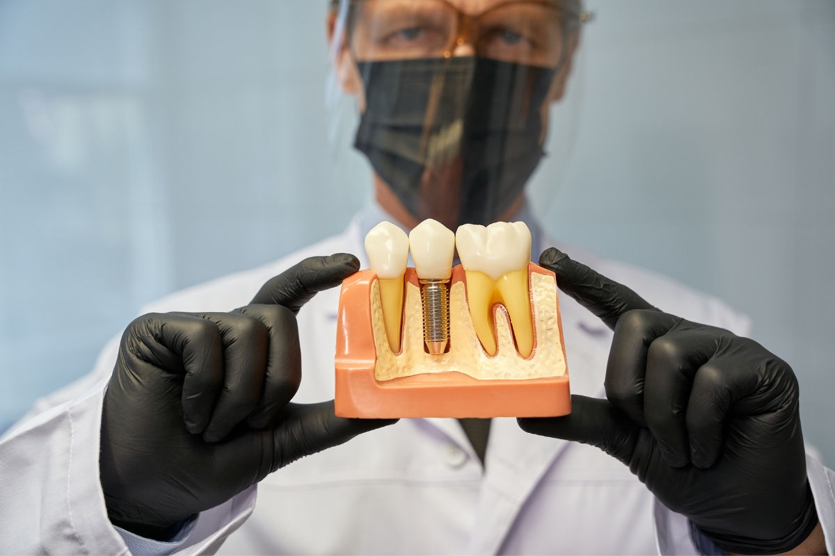 How Soon Do Gums Recover After Implants